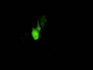 fluoropreop2