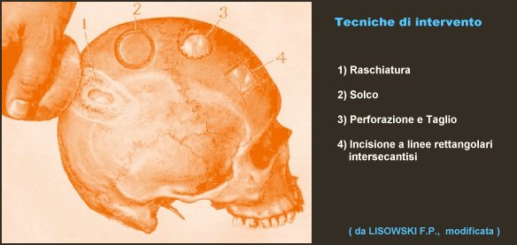 Tecniche di Trapanazione