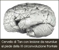 Cervello