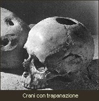 crani con trapanazione